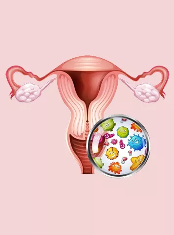 Pyosalpinx: Meaning, Symptoms, Causes & Effective Treatment