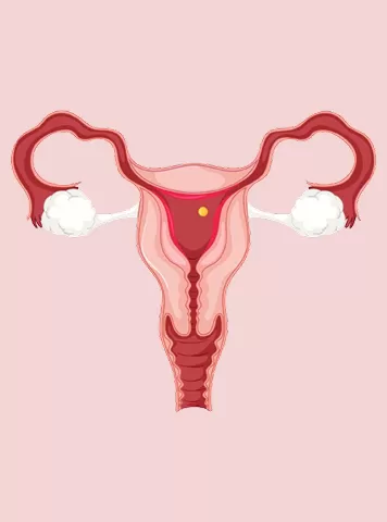 Small Uterus Symptoms: Causes, Diagnosis & Impact on Fertility