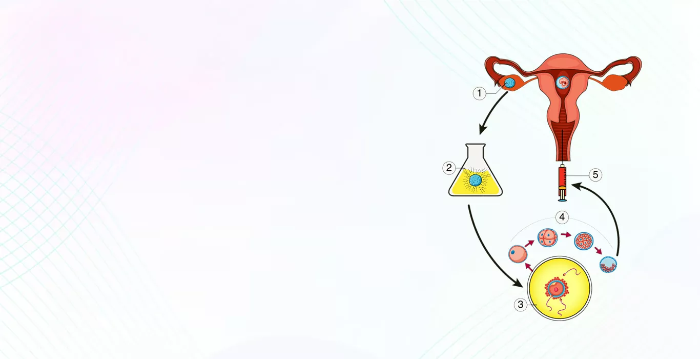 IVF and Embryo Transfer Process