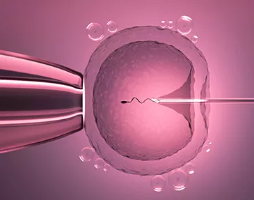 Treatments Offered Intracytoplasmic Sperm Injection (ICSI)